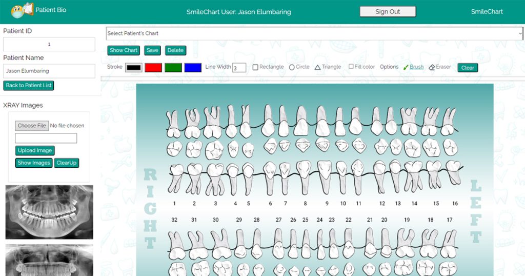 Jason Elumbaring's dental chart editing page